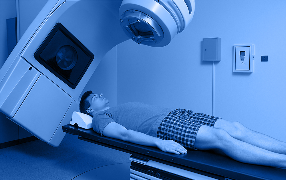 Radiothérapie personnalisée : ce que change le test NovaGray RILA Breast & Prostate